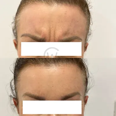 Medycyna Estetyczna Gawlińska-Wróbel Bielsko-Biała